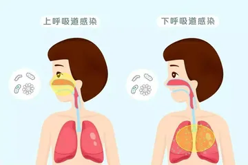 了解儿童呼吸道感染，做好护理工作1