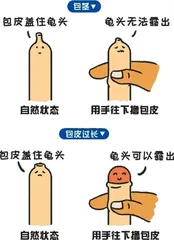 青少年包皮过长或包茎是否需要治疗？