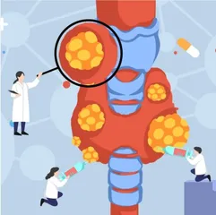 青少年甲状腺疾病不可忽视