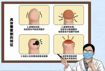 如何预防和治疗青春期男性包茎导致的健康问题1