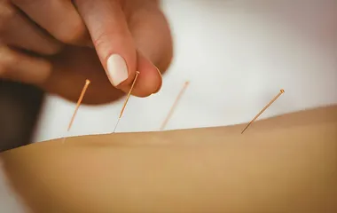 中医如何治疗青少年日光性皮炎?1