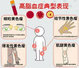 青少年高脂血症的生活方式调理
