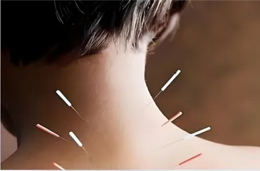 如何干预青少年心理健康问题？