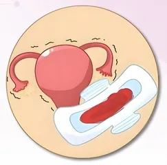 解读青春期女性异常子宫出血