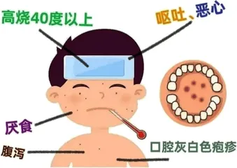 如何治疗儿童疱疹性咽峡炎，减轻咽喉疼痛