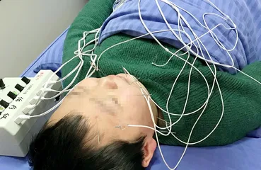 青少年面瘫了怎么办？