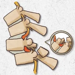 青少年脊髓损伤后如何进行康复训练？