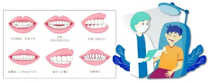 儿童青少年牙齿畸形如何矫正？