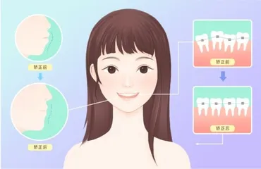 儿童青少年牙齿畸形如何矫正？1
