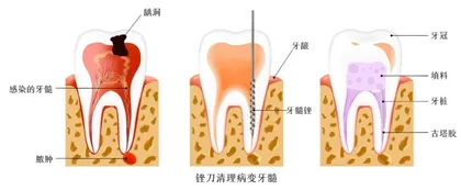 “把根留住，把牙保住”
