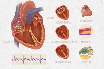 心房颤动解析