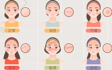 青春期痤疮的形成原因与应对策略