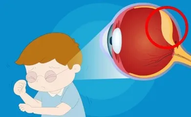 突然视物模糊，警惕视网膜脱落