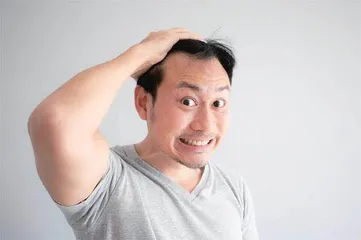 “脱发焦虑”为何袭击年轻人？