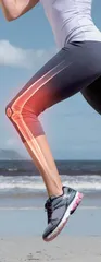 1/4