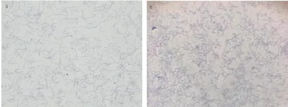 乌梅对柱状黄杆菌抑菌效果研究20
