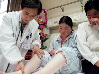 红斑狼疮该咋治?2
