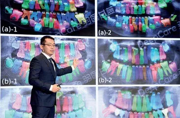 两亿人都要整牙?但中国只有6000多名正畸医生3