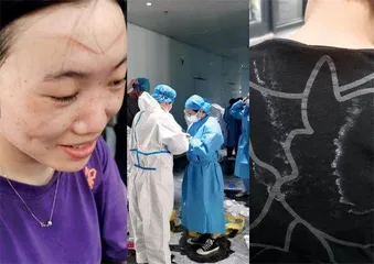 张黎刚:探索全民健康下的责任新维度2