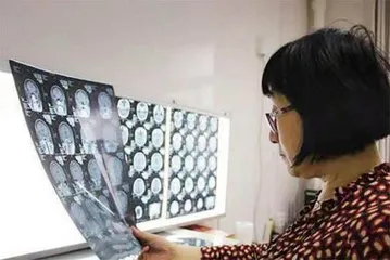 创新探索,肺癌医生的担当2