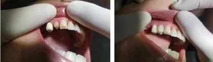 何乐:从零开始,做口腔材料的变革者1