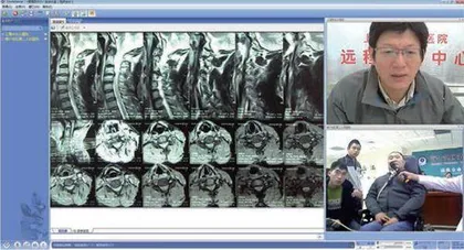 大病不出疆,南疆人如今这样看病5
