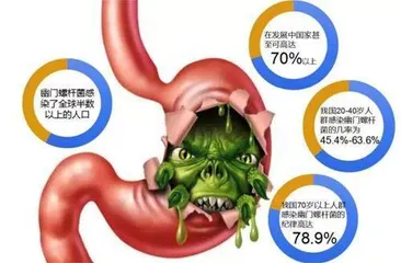 警惕细菌性病原体重视防控幽⻔螺杆菌2