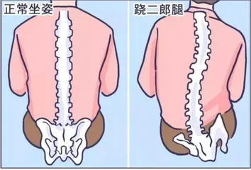 影响颜值跷⼆郎腿真的会导致“脸⼤”?1