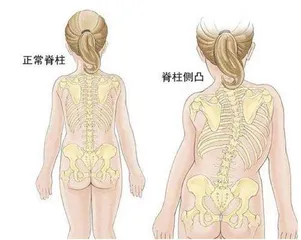 影响颜值跷⼆郎腿真的会导致“脸⼤”?5