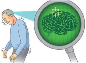突破性人工智能新疗法以十倍的速度识别帕金森病2