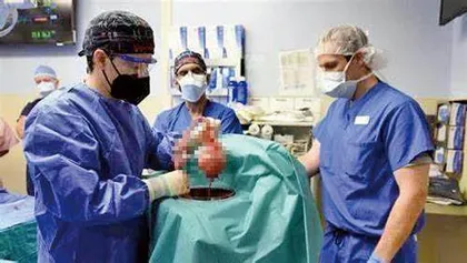 人类首次将经过转基因的猪心脏移植入人体内有望解决人体移植器官短缺问题1