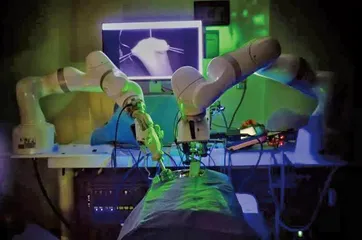 机器人首次独立完成腹腔镜手术，准确性高于外科医生
