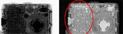 将XX射线技术结合深度学习算法可提早检测体内潜在致命肿瘤1