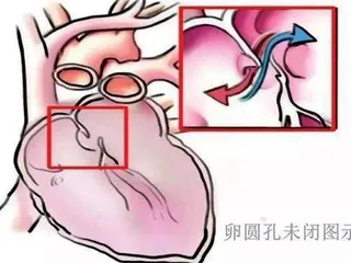 “小⼼眼”容易引发头疼头晕3