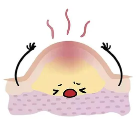 鸡皮疙瘩与鸡皮肤到底是什么?1
