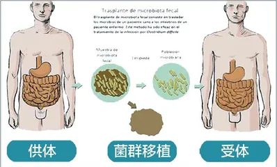 粪便能治癌症?肠菌与免疫“密不可分”1