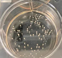 为神经系统疾病研究提供新途径全球最小脑电帽可拓展微型大脑类器官的研究与测试4