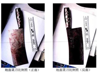 手掌被丈夫砍断后,她终于决定离婚1