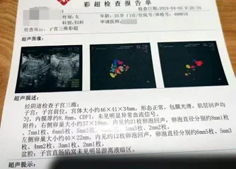 当女孩们决定“捐”卵2