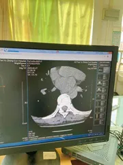 健身重伤后,一个单身女性的自救与思考2