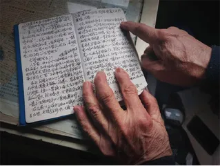 左肾消失之后3