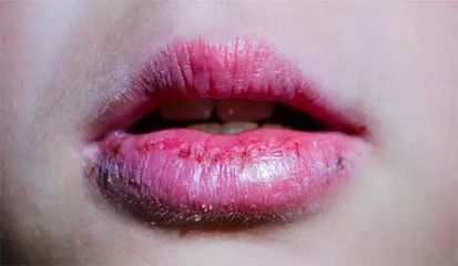 辟谣1