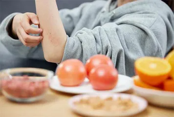 过敏性疾病的认知与疗法1