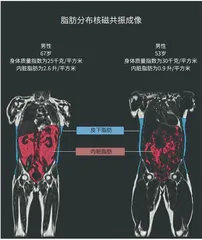 外瘦内胖,你“中枪”了吗?1