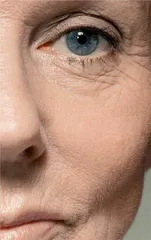 永远年轻的肌肤：美容业的谎言？