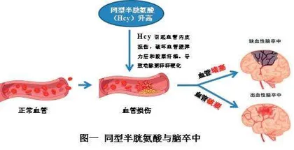 脑卒中患者需要常规补充叶酸吗