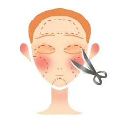双眼皮怎么割又美又安全2