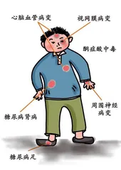 降糖误区请“绕道而行”7