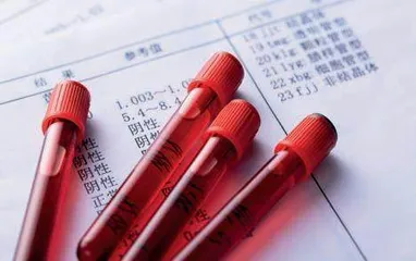 为什么体检要抽好几管血