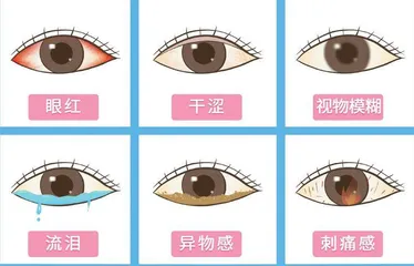 视疲劳时,闭眼休息还是远眺1
